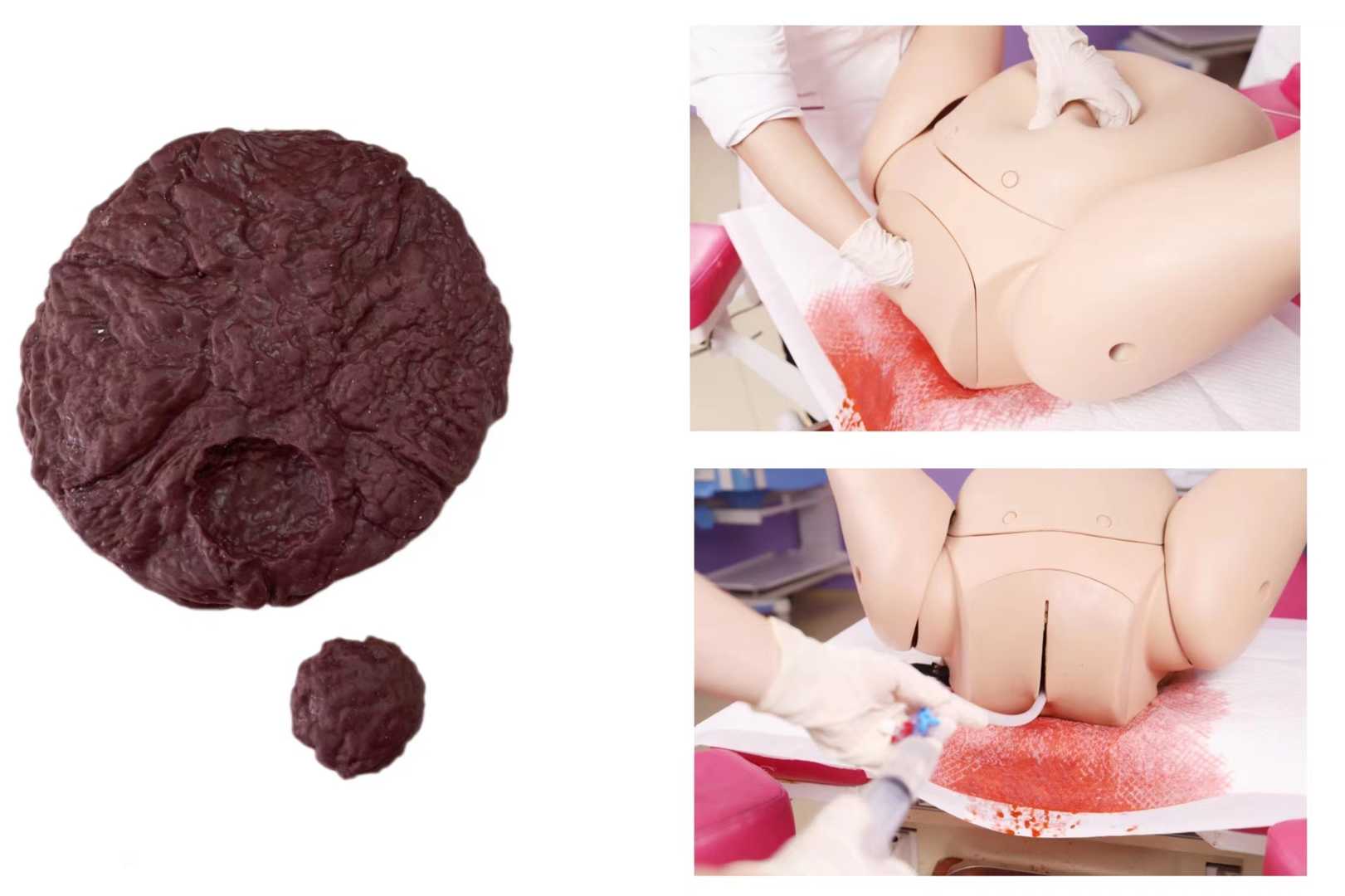 Complete Postpartum Hemorrhage Simulator