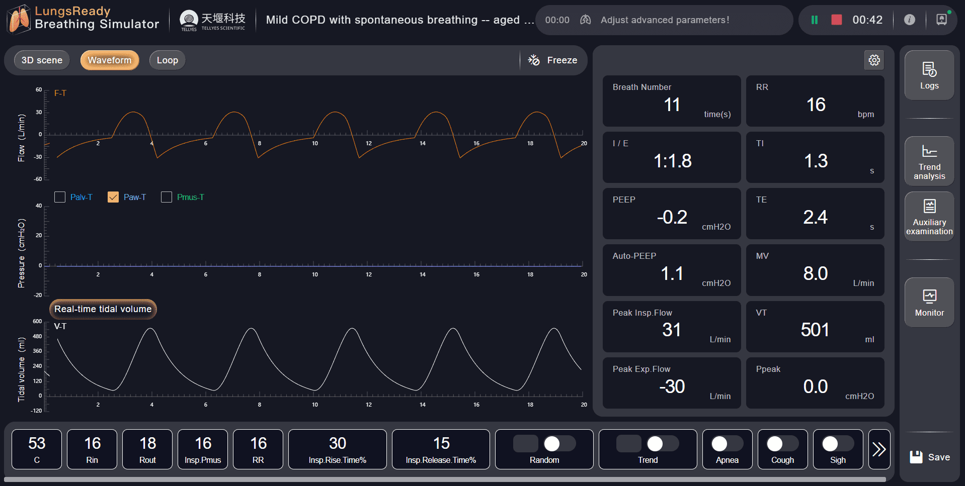 LungsReady Breathing Simulator